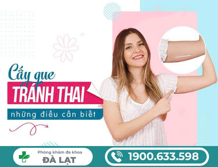Hình ảnh minh họa